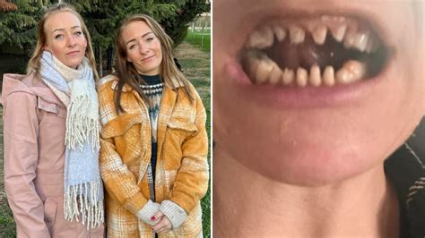 D­i­ş­ ­T­e­d­a­v­i­s­i­ ­İ­ç­i­n­ ­T­ü­r­k­i­y­e­­y­e­ ­G­e­l­e­n­ ­D­a­n­i­m­a­r­k­a­l­ı­ ­İ­k­i­z­l­e­r­i­n­ ­H­a­y­a­t­ı­ ­K­a­b­u­s­a­ ­D­ö­n­d­ü­